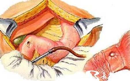 誰應(yīng)主動去做胃腸鏡檢查